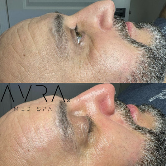 Gentleman Hydrafacial